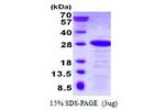 DBNDD2, 1-161aa Human