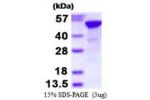 RBBP4, 1-425aa Human