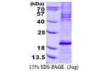 BCL2L11, 1-138aa Human