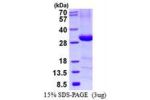 C4BPB, 18-252aa, Human