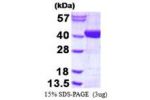 ADPRHL2, 1-363aa, Human