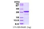NOL3, 1-208aa, Human