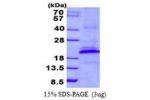 KLRB1, 67-225aa, Human