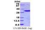 TULP1, 290-542aa, Human