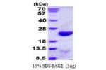 UBE2C, 1-179aa, Human