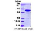 F3, 33-251aa, Human