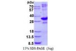 MED7, 1-233aa, Human