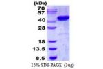 CSNK2A2, 1-350aa, Human