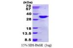 DKK2, 34-259aa, Human