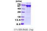 TDG, 1-410aa, Human