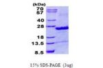 SEC22B, 14-194aa, Human