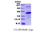 CD27, 21-191aa, Human