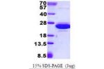 CNRIP1, 1-164aa, Human