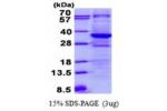 TTC33, 1-262aa, Human