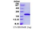 RNF181, 1-153aa, Human