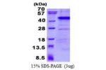 ANKRD1, 1-319aa, Human