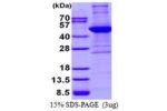 ACTA2, 3-377aa, Human