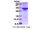 CDK4, 1-303aa, Human