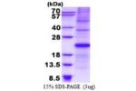 CDKN1A, 1-164aa, Human