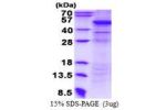 UQCRC2, 15-453aa, Human