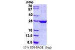 ULBP1, 26-216aa, Human