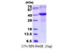 RNLS, 18-342aa, Human