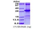 CD84, 22-225aa, Human
