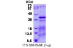 CHMP5, 1-219aa, Human