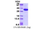 MRTO4, 1-239aa, Human