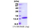 POLR2J3, 1-115aa, Human