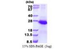 ECSIT, 19-217aa, Human