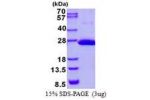 COMMD9, 1-198aa, Human