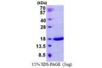 Lgals7, 1-136aa, Mouse