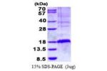 TSC22D3, 1-134aa, Human