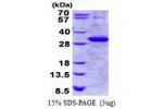 KLK1, 25-262aa, Human