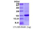 ASPRV1, 191-326aa, Human