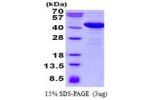 NCF4, 1-339aa, Human