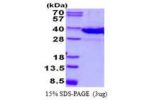 LGALS8, 1-316aa, Mouse