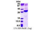 ASGR2, 80-311aa, Human