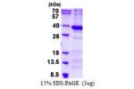 BCDIN3D, 1-292aa, Human