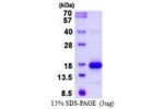 LGALS1, 1-135aa, Mouse