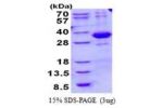 SPSB2, 1-263aa, Human