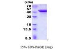 ERLIN2, 25-339aa, Human