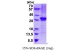 CD1B, 18-303aa, Human