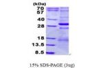 NDUFS3, 37-264aa, Human