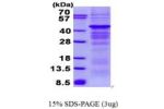PRKAB1, 1-270aa, Human