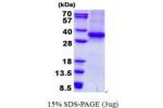 ASMT, 1-298aa, Human