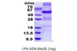 PHF11, 1-331aa, Human