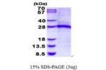 TNNI1, 1-187aa, Human