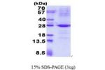 TRAPPC4, 1-219aa, Human
